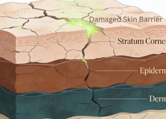 Skin barrier repair routine for melanin-rich skin