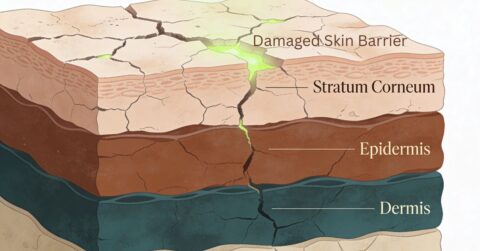 Skin barrier repair routine for melanin-rich skin